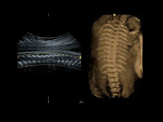 Клинические изображения УЗИ аппарат GE HealthCare Voluson E8 