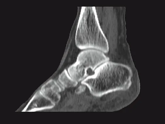 Клинические изображения МРТ аппарат GE SIGNA Voyager 1.5T