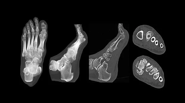 Клинические изображения GE HealthCare Revolution EVO компьютерный томограф