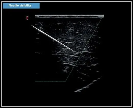 Клинические изображения УЗИ аппарат Esaote MyLab X5