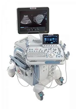 УЗИ аппарат Esaote MyLab Twice
