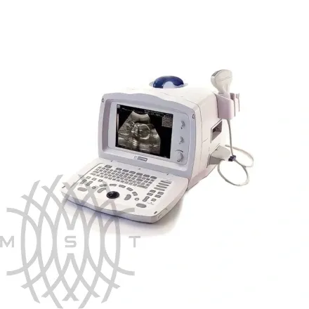 УЗИ аппарат Mindray DP 2200 портативный
