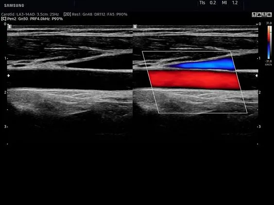 Клинические изображения Samsung Medison HS60 УЗИ аппарат