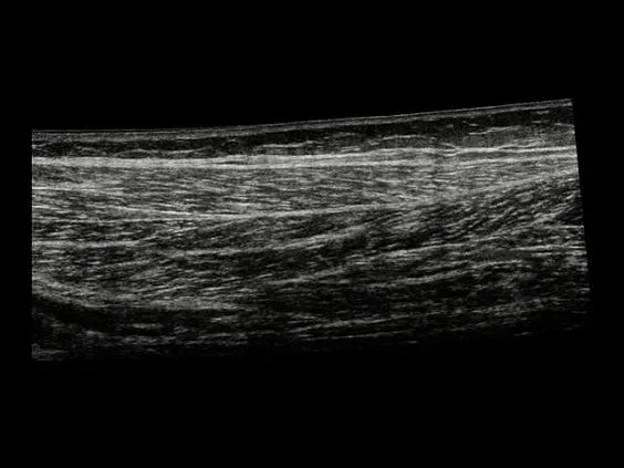 Клинические изображения УЗИ аппарат НПО СКАНЕР РУСКАН 60