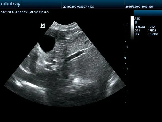 Клинические изображения УЗИ аппарат Mindray DP-50 Vet ветеринарный портативный