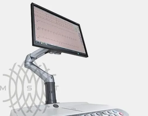 Cтресс-система CASE