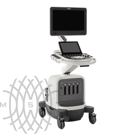 Philips Affiniti CVx ультразвуковой аппарат