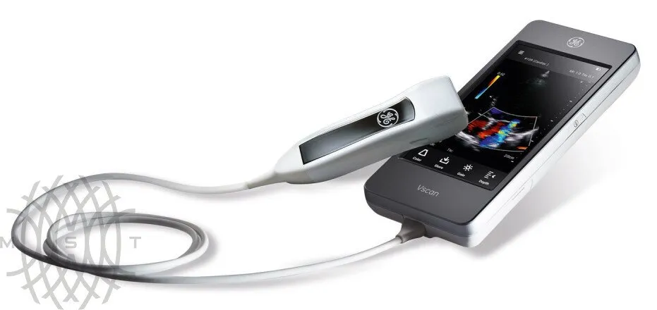 УЗИ аппарат GE HealthCare Vscan Air карманный