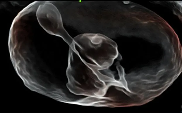 Клинические изображения УЗИ аппарат Mindray Imagyn I9