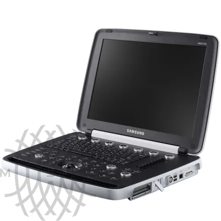 Samsung Medison HM70A УЗИ аппарат портативный