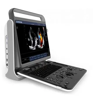 УЗИ аппарат Chison SonoTouch 60 портативный