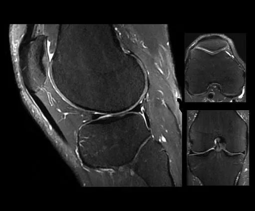 Клинические изображения МРТ аппарат GE SIGNA Architect 3T