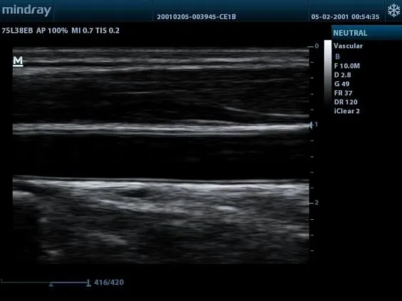 Клинические изображения УЗИ аппарат Mindray DP-20 Vet ветеринарный портативный