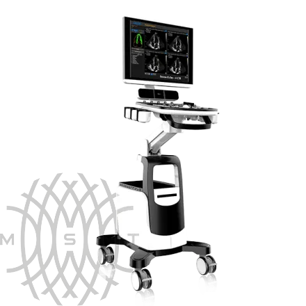 УЗИ аппарат Chison Qbit 7