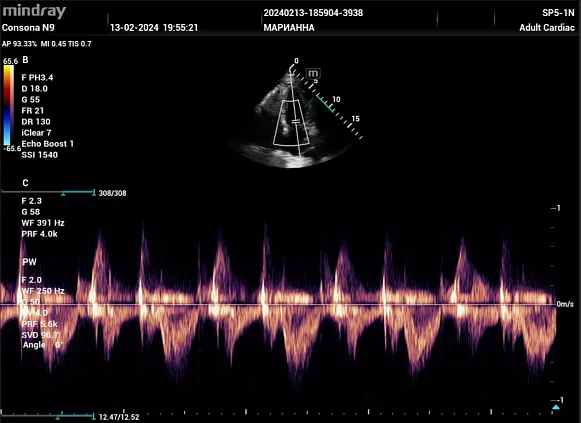 Клинические изображения УЗИ аппарат Mindray Consona N9