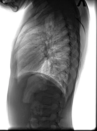 Клинические изображения Флюорограф цифровой С.П.Гелпик РЕНЕКС Ф-5000