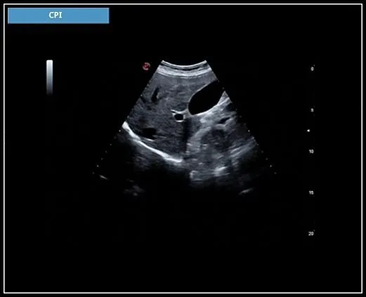 Клинические изображения УЗИ аппарат Esaote MyLab X7