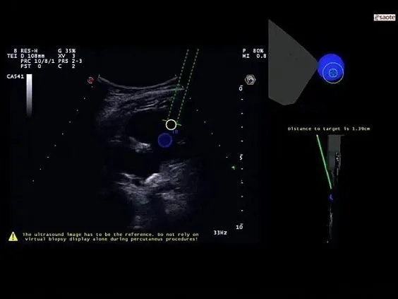 Клинические изображения УЗИ аппарат Esaote MyLab Eight