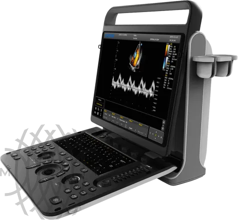 УЗИ аппарат Chison Sonotouch 60 OB портативный