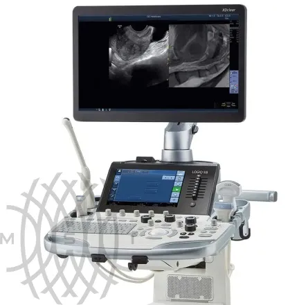 GE Logiq S8 XDclear ультразвуковая диагностическая система 