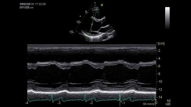 Клинические изображения Ультразвуковая диагностическая система GE HealthCare Vivid iQ портативная