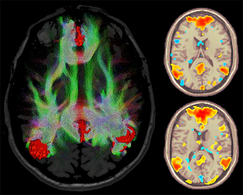 Клинические изображения МРТ аппарат GE SIGNA Premier 3T