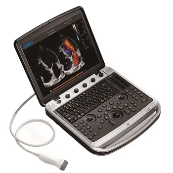 УЗИ аппарат Chison SonoTouch 80 Expert портативный