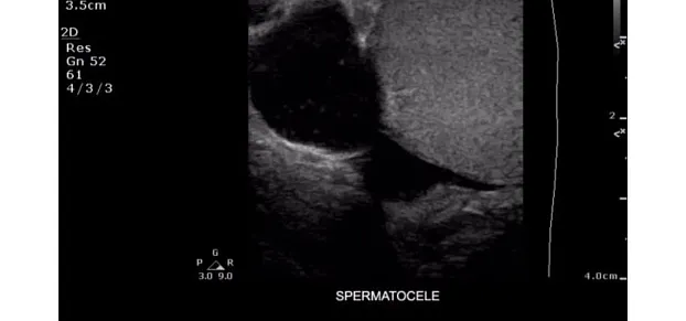 Клинические изображения Philips ClearVue 350 ультразвуковой аппарат