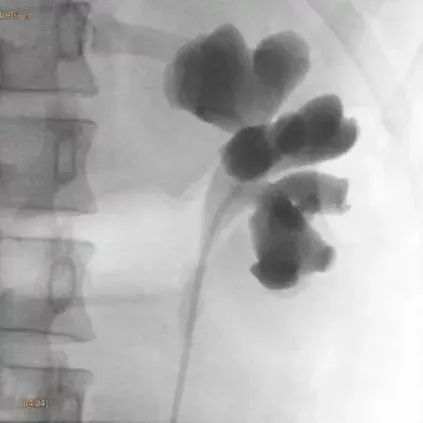 Клинические изображения Philips Zenition 70 C-дуга