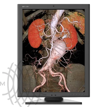 Монитор медицинский Jusha C350G