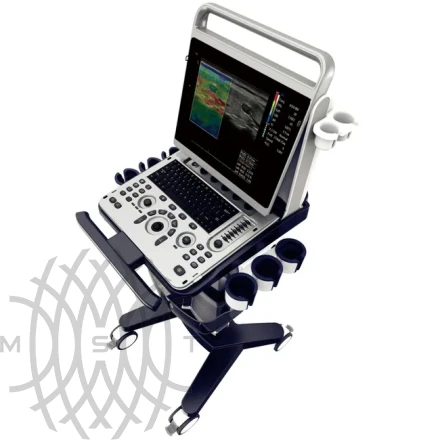 УЗИ аппарат Chison SonoTouch 60 портативный