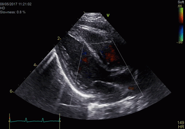 Клинические изображения УЗИ аппарат GE HealthCareVivid E90