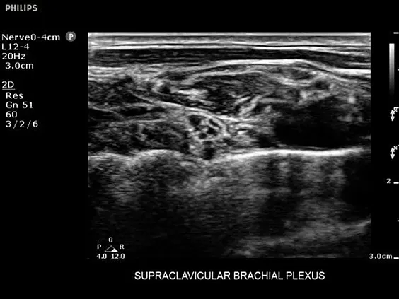Клинические изображения Philips Sparq ультразвуковой аппарат