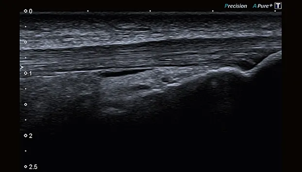 Клинические изображения Canon Xario 100G ультразвуковой аппарат