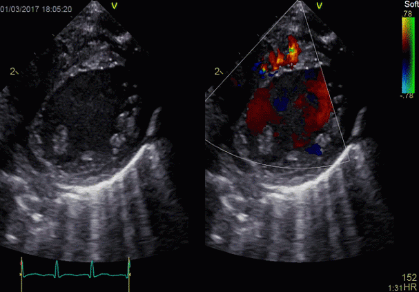 Клинические изображения УЗИ аппарат GE HealthCareVivid E90