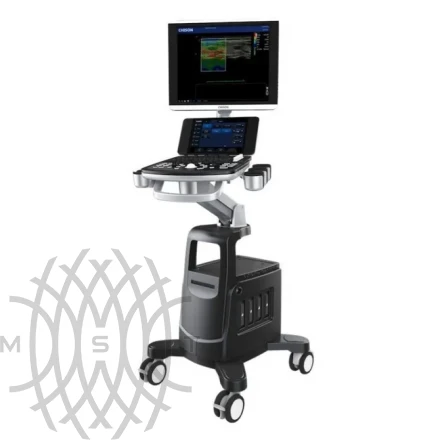 УЗИ аппарат Chison Qbit 11