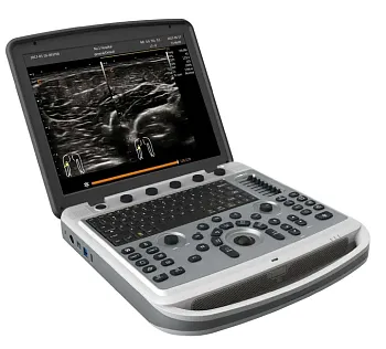 УЗИ аппарат Chison SonoTouch 80 портативный