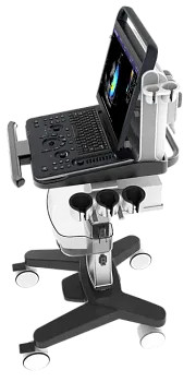 УЗИ аппарат Chison Sonotouch 60 OB портативный