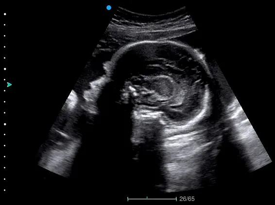 Клинические изображения УЗИ аппарат SIUI Apogee 5800