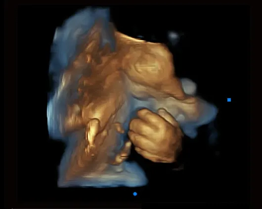 Клинические изображения УЗИ аппарат Chison Qbit 7