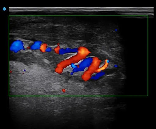 Клинические изображения SIUI Apogee 6500 ультразвуковой аппарат