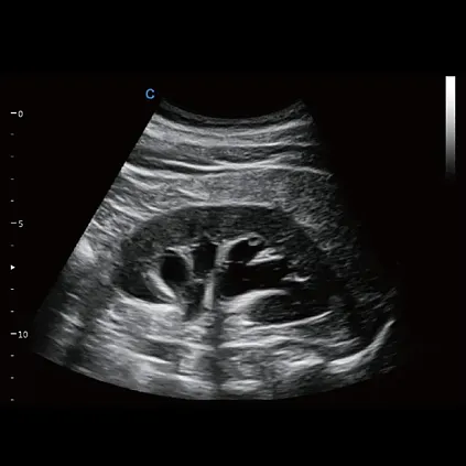 Клинические изображения УЗИ аппарат Chison Qbit 10