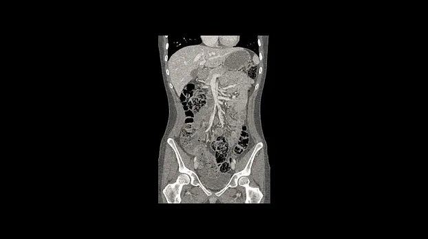 Клинические изображения Компьютерный томограф GE Discovery RT