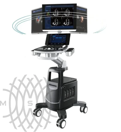 УЗИ аппарат Chison Qbit 11