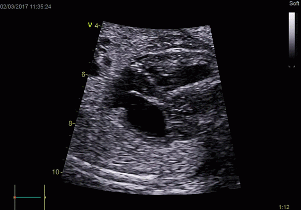 Клинические изображения УЗИ аппарат GE HealthCareVivid E90