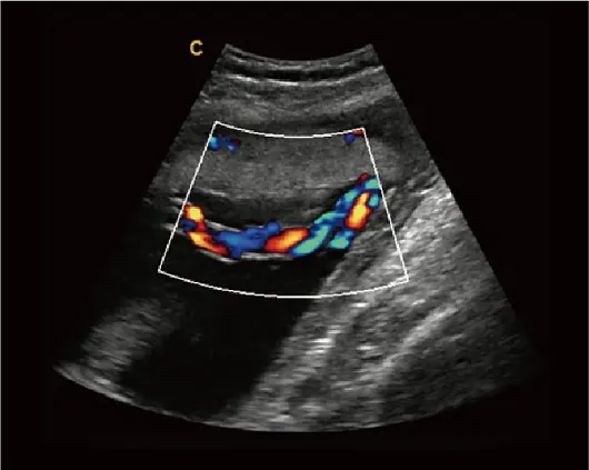 Клинические изображения Chison i9 ультразвуковой аппарат