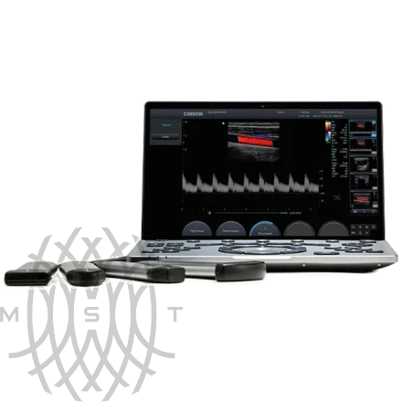 УЗИ аппарат Chison SonoTouch 50 (Sonoair) портативный