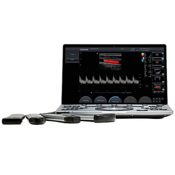 УЗИ аппарат Chison SonoTouch 50 (Sonoair) портативный