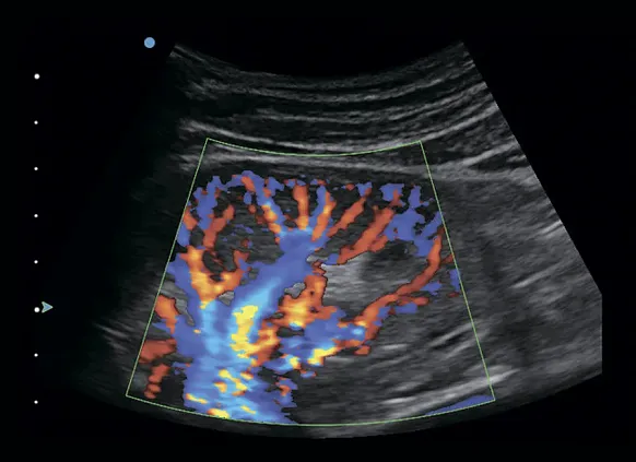 Клинические изображения SIUI Apogee 1100 УЗИ аппарат портативный