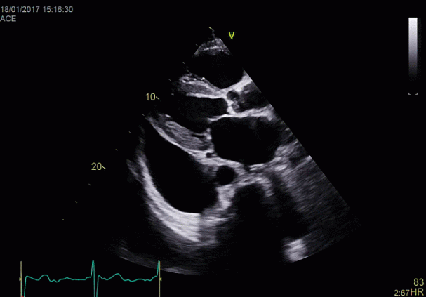Клинические изображения УЗИ аппарат GE HealthCareVivid E90
